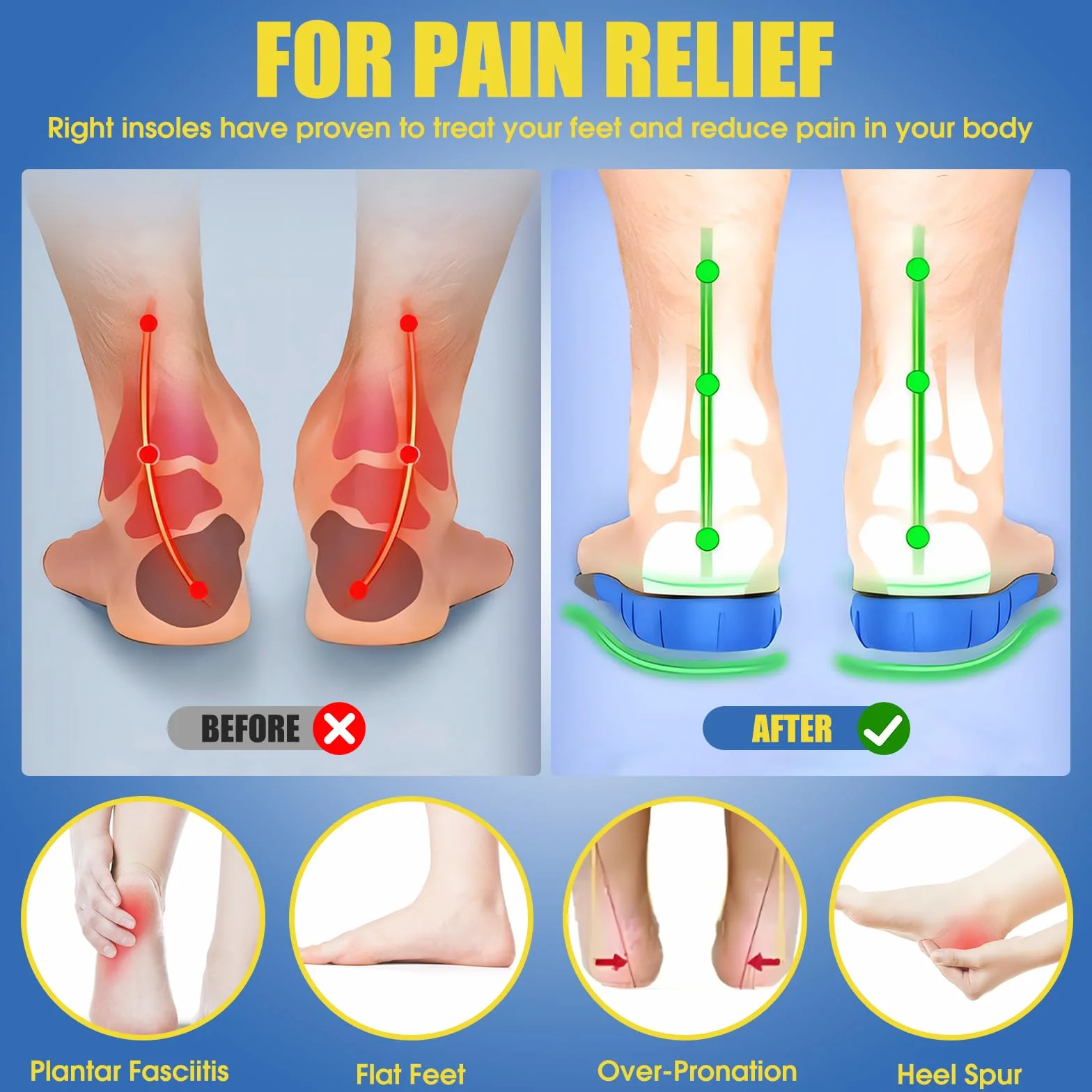 Semelles Orthopédiques pour Fasciite Plantaire, Pieds Plats, Épine Calcanéenne, Semelles Chaussures pour Confort Optimal en Position Debout Toute la Journée – Homme & Femme - L